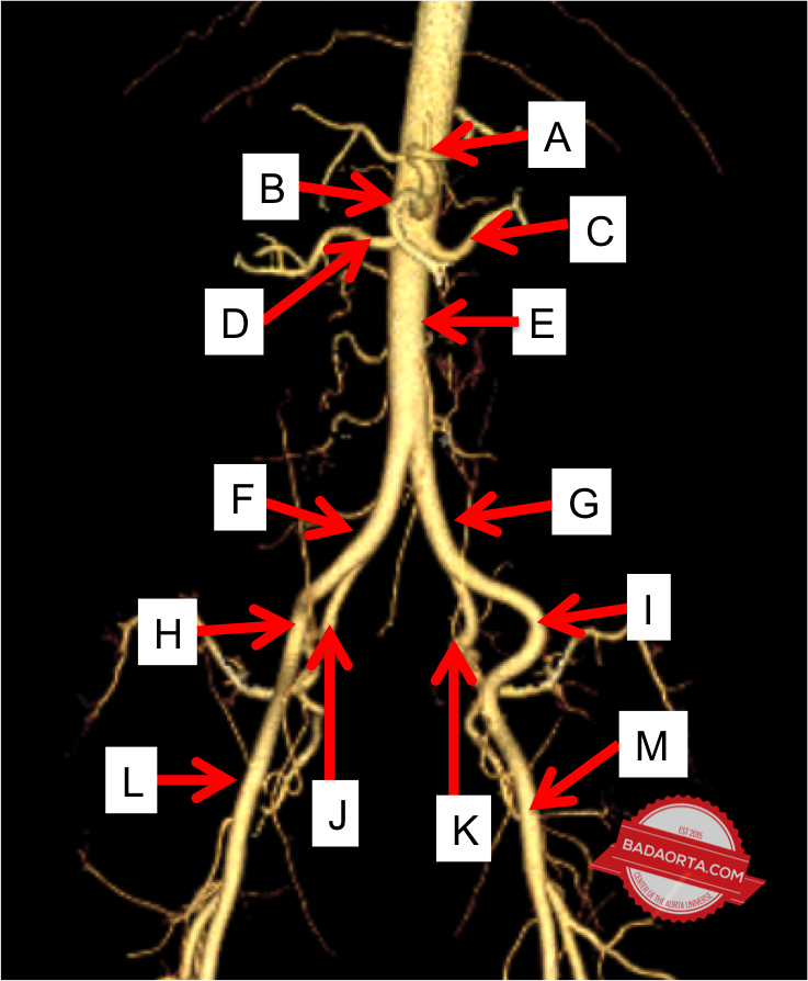 Anatomy of the Abdominal Aorta