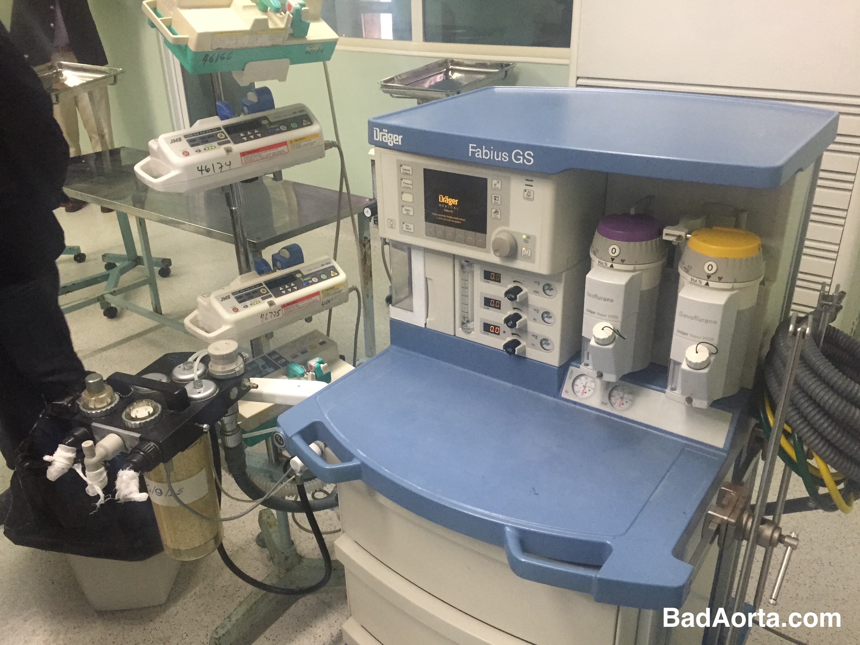 Anesthesia machine for open heart surgery in Havana, Cuba