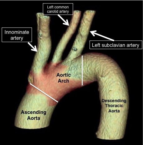 Aortic arch with great vessels (labeled)