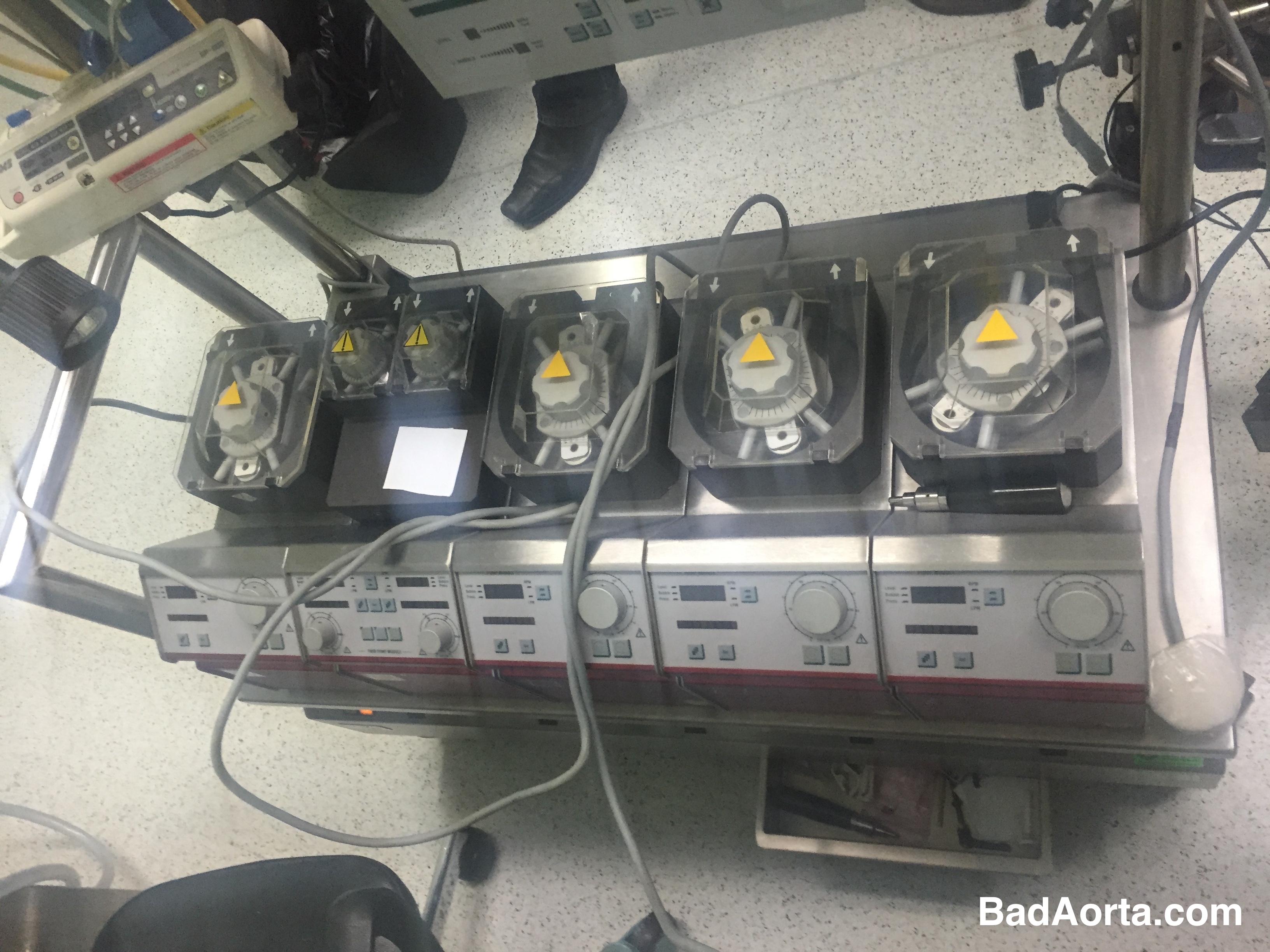 Heart bypass machine in Havana, Cuba