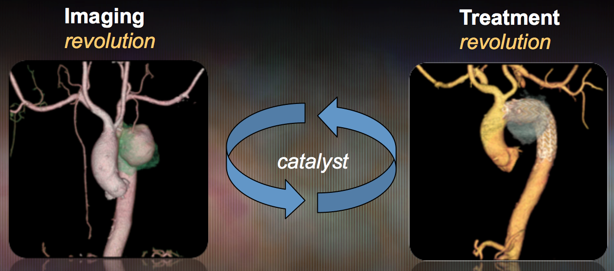 Positive Feedback Loop for Aortic Treatments